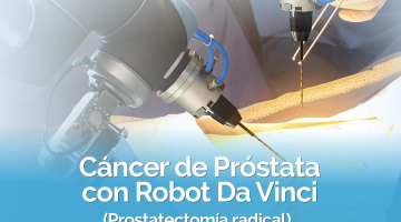 Cáncer de Próstata con Robot Da Vinci (Prostatectomía radical)