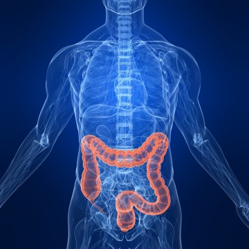 What you should know about colorectal cancer
